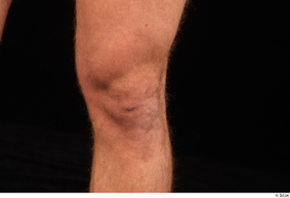 Herbert 10yers knee nude 0004.jpg